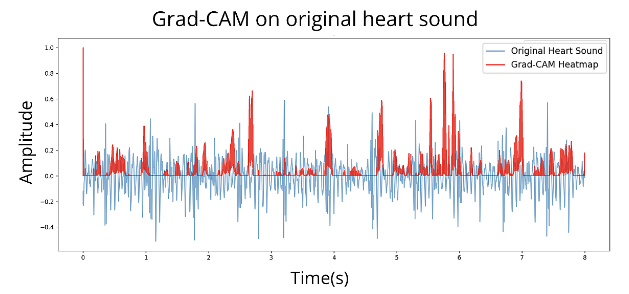 Heart Sound Classification